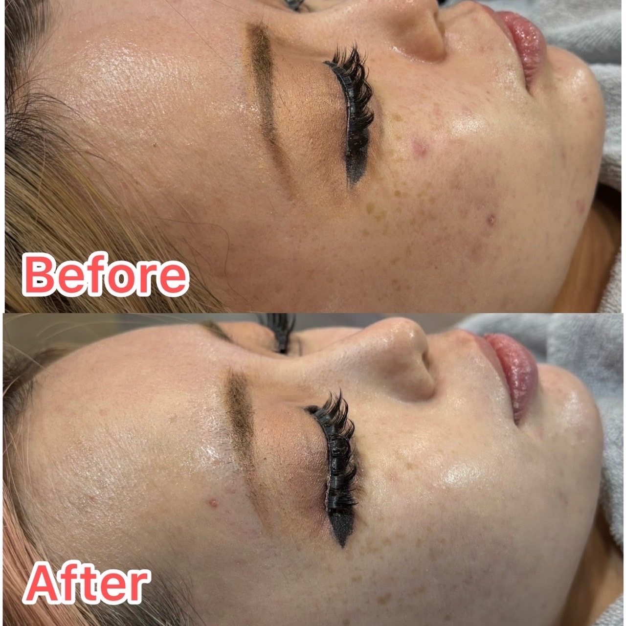 ビフォーアフター1