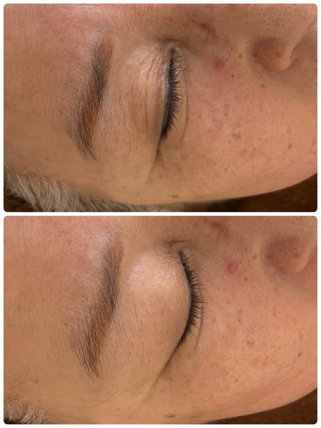 ビフォーアフター2