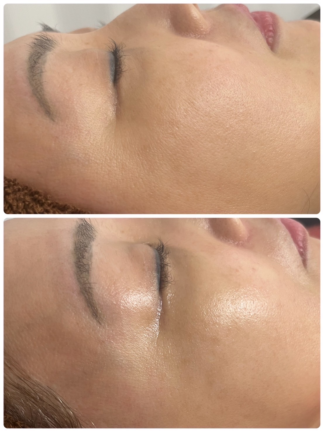 ビフォーアフター3